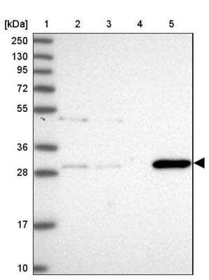 Western Blot: GSTO2 Antibody [NBP2-14075]