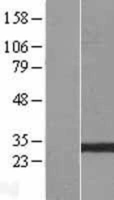 Western Blot: GSTO2 Overexpression Lysate [NBL1-11375]