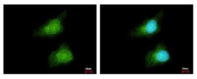 Immunocytochemistry/ Immunofluorescence: Glutathione S-Transferase pi 1/GSTP1 Antibody [NBP2-16757]