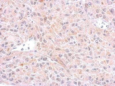 Immunohistochemistry-Paraffin: Glutathione S-Transferase pi 1/GSTP1 Antibody [NBP2-16757]