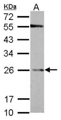 Western Blot: Glutathione S-Transferase pi 1/GSTP1 Antibody [NBP2-16757]