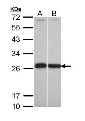 Western Blot: Glutathione S-Transferase pi 1/GSTP1 Antibody [NBP2-16757]