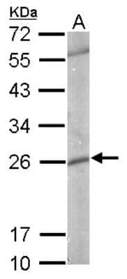 Western Blot: Glutathione S-Transferase pi 1/GSTP1 Antibody [NBP2-16757]