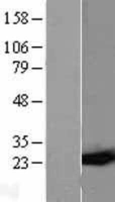 Western Blot: Glutathione S-Transferase pi 1/GSTP1 Overexpression Lysate [NBL1-11376]