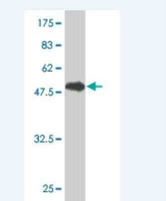 Western Blot: GSTT1 Antibody (2E10-1B2) [H00002952-M01]