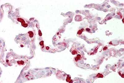 Immunohistochemistry-Paraffin: GSTT1 Antibody [NBP1-53049]