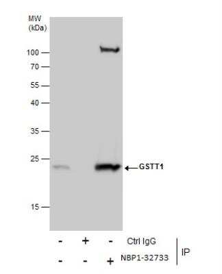 Immunoprecipitation: GSTT1 Antibody [NBP1-32733]