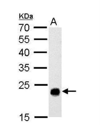 Western Blot: GSTT1 Antibody [NBP1-32733]