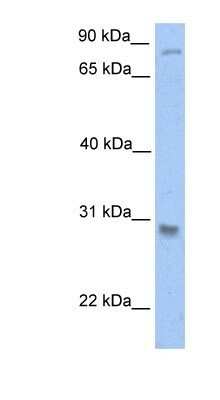 Western Blot: GSTT1 Antibody [NBP1-53049]