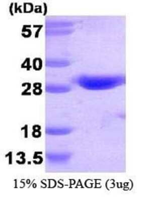 SDS-PAGE: Recombinant Human GSTT1 His Protein [NBC1-28782]