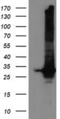 Western Blot: GSTT2 Antibody (OTI3B6) [NBP2-03126]