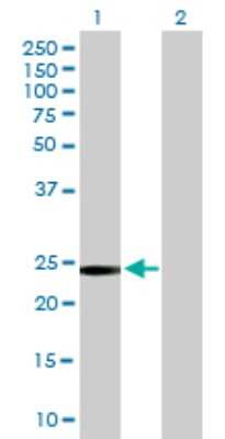 Western Blot: GSTT2 Antibody [H00002953-B01P]