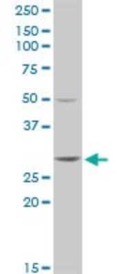 Western Blot: GSTT2 Antibody [H00002953-D01P]