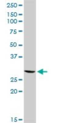 Western Blot: GSTT2 Antibody [H00002953-D01P]