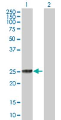 Western Blot: GSTT2 Antibody [H00002953-D01P]