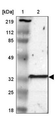 Western Blot: GSTT2B Antibody [NBP1-86186]