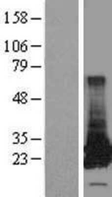 Western Blot: GSTT2 Overexpression Lysate [NBL1-11378]