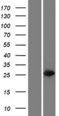 Western Blot: GSTT2B Overexpression Lysate [NBP2-10660]