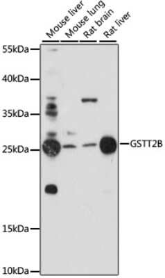 Western Blot: GSTT2B AntibodyAzide and BSA Free [NBP3-04458]