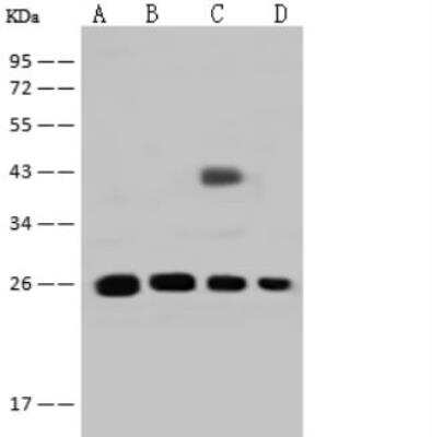 Western Blot: GSTT2B Antibody [NBP3-06612]