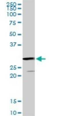 Western Blot: GSTZ1 Antibody (1G12) [H00002954-M01]