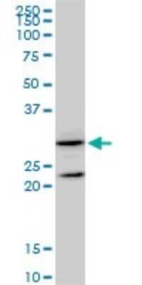 Western Blot: GSTZ1 Antibody (1G12) [H00002954-M01]