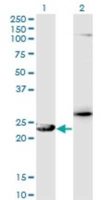 Western Blot: GSTZ1 Antibody (1G12) [H00002954-M01]