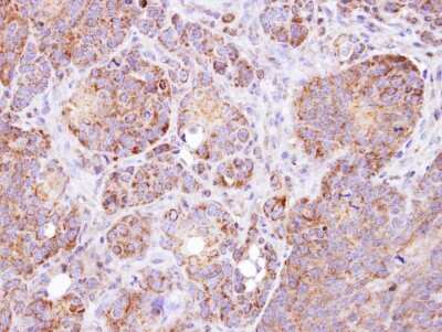 Immunohistochemistry-Paraffin: GSTZ1 Antibody [NBP1-33693]