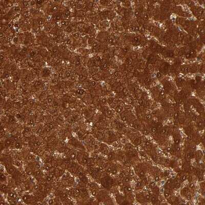 Immunohistochemistry-Paraffin: GSTZ1 Antibody [NBP1-83320]