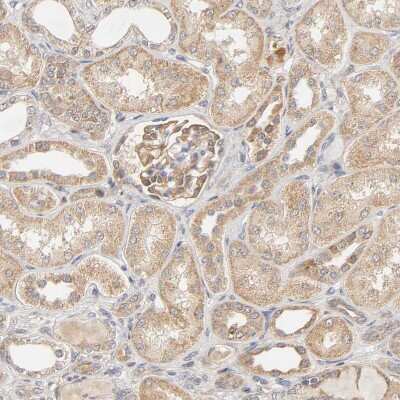 Immunohistochemistry-Paraffin: GSTZ1 Antibody [NBP1-83320]