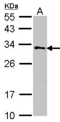 Western Blot: GSTZ1 Antibody [NBP1-33693]