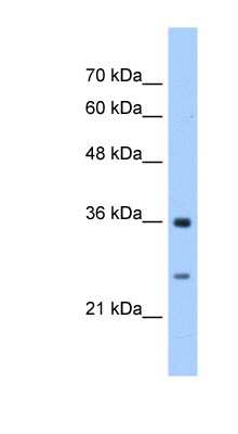 Western Blot: GSTZ1 Antibody [NBP1-55137]