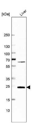 Western Blot: GSTZ1 Antibody [NBP1-83320]