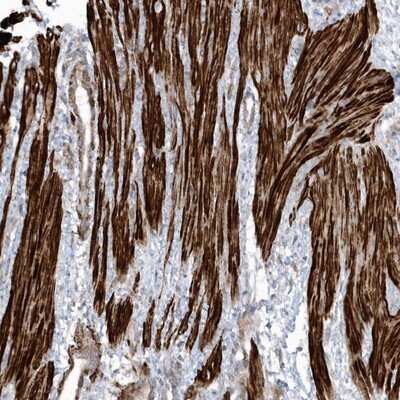 Immunohistochemistry-Paraffin: GTDC1 Antibody [NBP1-83725]