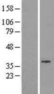 Western Blot: GTDC1 Overexpression Lysate [NBL1-11381]