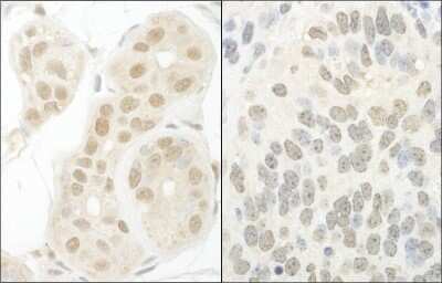 Immunohistochemistry: GTF2A1 Antibody [NBP1-46216]