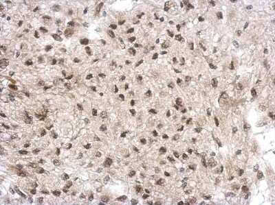 Immunohistochemistry-Paraffin: GTF2A1 Antibody [NBP2-16760]