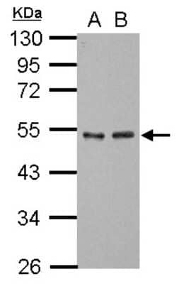 Western Blot: GTF2A1 Antibody [NBP2-16760]