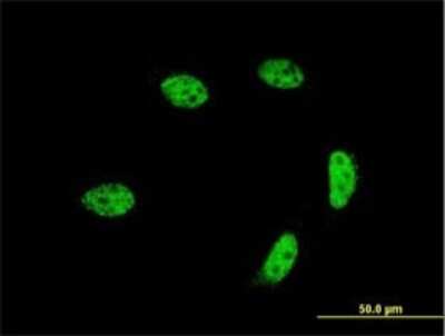 Immunocytochemistry/ Immunofluorescence: GTF2A1L Antibody (2E3) [H00011036-M02]