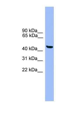 Western Blot: GTF2A1L Antibody [NBP1-69206]