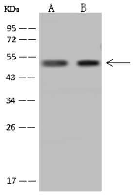 Western Blot: GTF2A1L Antibody [NBP2-97826]