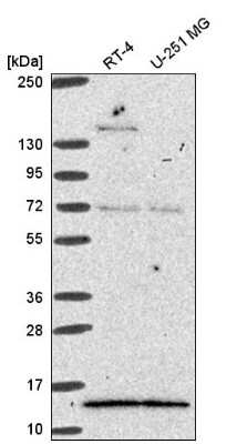 Western Blot: GTF2A2 Antibody [NBP2-55408]