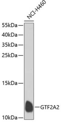 Western Blot: GTF2A2 AntibodyBSA Free [NBP3-04408]