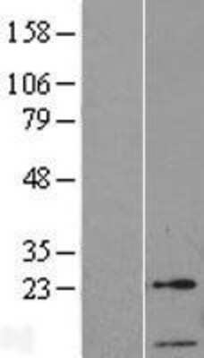 Western Blot: GTF2A2 Overexpression Lysate [NBL1-11383]