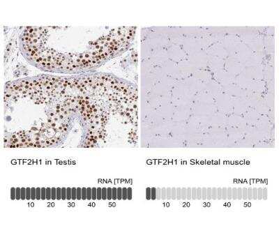 Immunohistochemistry-Paraffin: GTF2H1 Antibody [NBP2-38556]