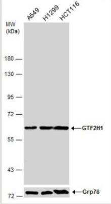 Western Blot: GTF2H1 Antibody [NBP2-16761]