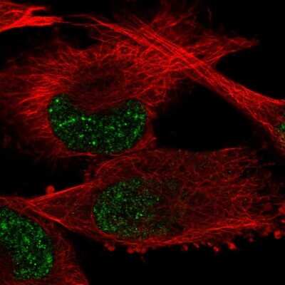 Immunocytochemistry/ Immunofluorescence: GTF2H2 Antibody [NBP2-56841]