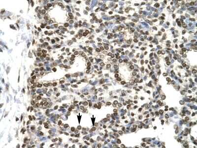 Immunohistochemistry: GTF2H2 Antibody [NBP2-87538]