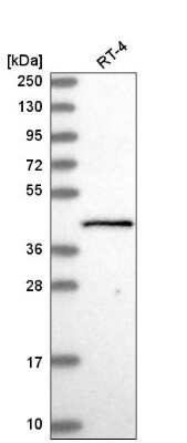 Western Blot: GTF2H2 Antibody [NBP2-56841]