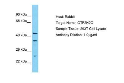 Western Blot: GTF2H2 Antibody [NBP2-87535]